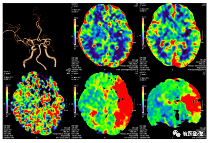 医学影像学简历_医学影像学简历_医学影像学简历