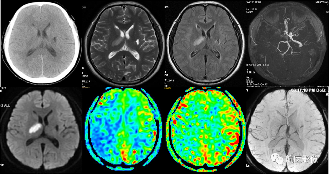 医学影像学简历_医学影像学简历_医学影像学简历