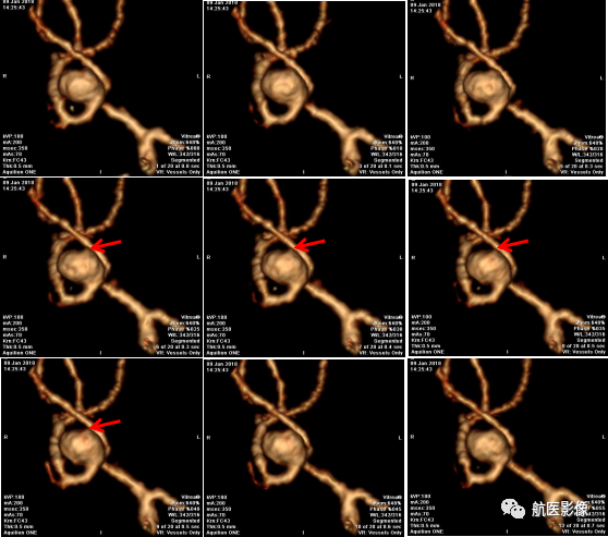 医学影像学简历_医学影像学简历_医学影像学简历