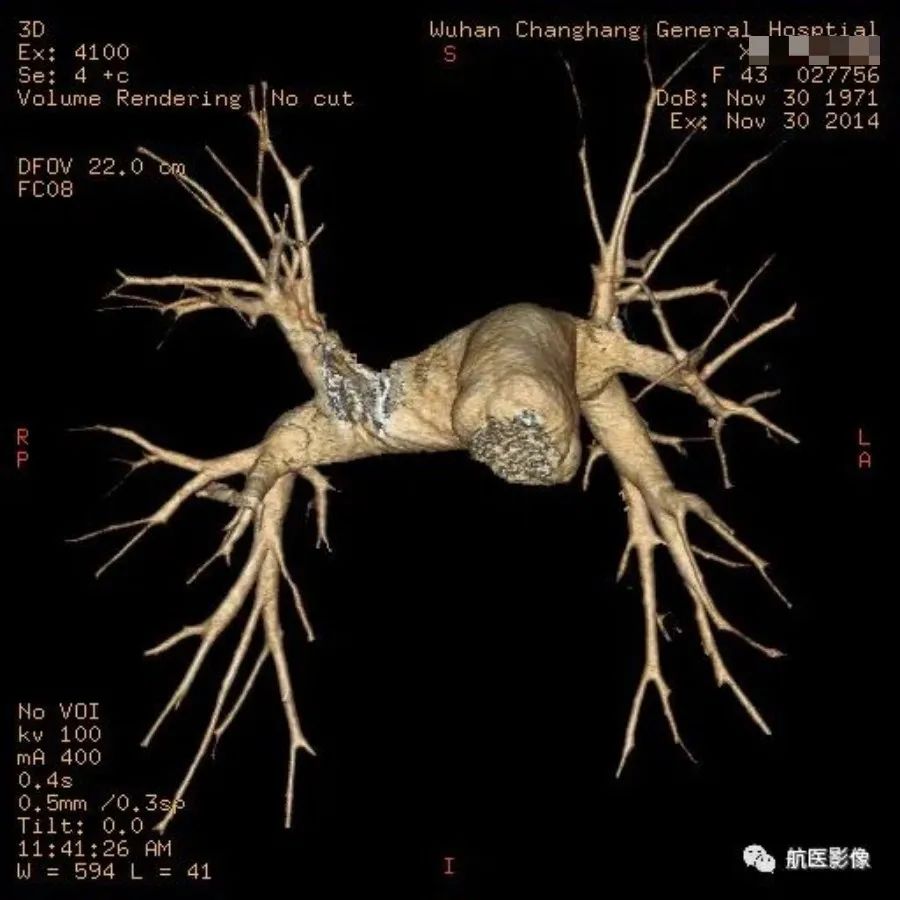 医学影像学简历_医学影像学简历_医学影像学简历