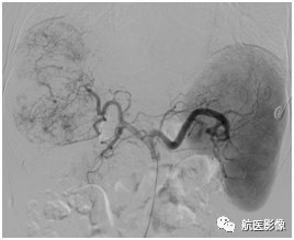 医学影像学简历_医学影像学简历_医学影像学简历