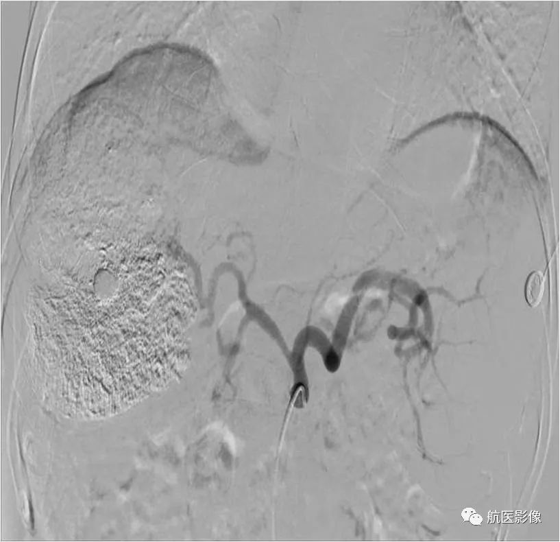医学影像学简历_医学影像学简历_医学影像学简历