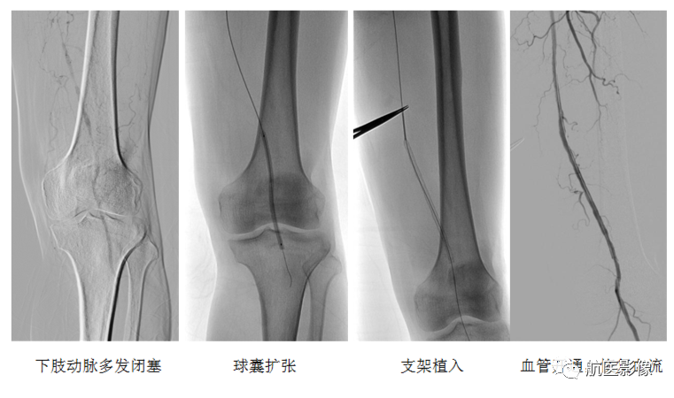医学影像学简历_医学影像学简历_医学影像学简历