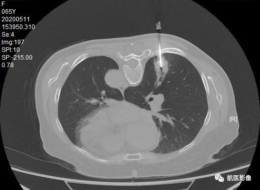 医学影像学简历_医学影像学简历_医学影像学简历