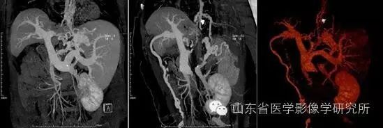 简历影像医学学位怎么写_简历影像医学学位怎么填_医学影像学简历
