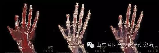 医学影像学简历_简历影像医学学位怎么写_简历影像医学学位怎么填