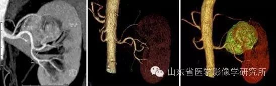 医学影像学简历_简历影像医学学位怎么写_简历影像医学学位怎么填