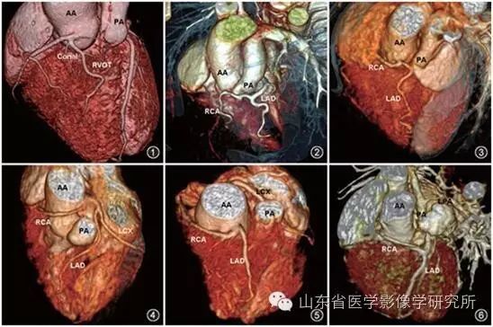 简历影像医学学位怎么填_医学影像学简历_简历影像医学学位怎么写
