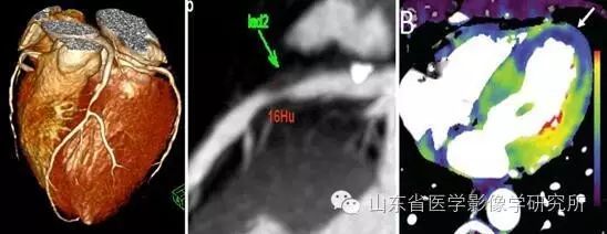 简历影像医学学位怎么填_医学影像学简历_简历影像医学学位怎么写
