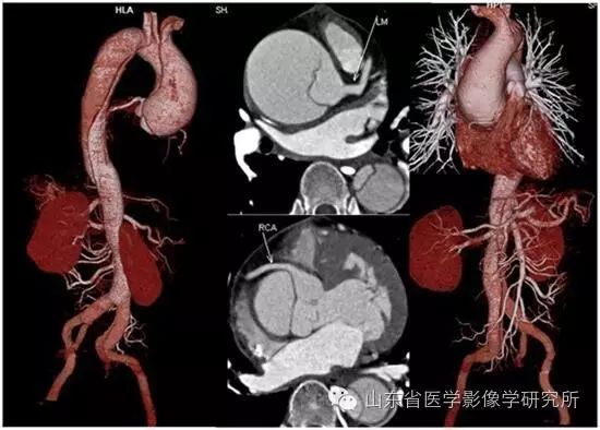 医学影像学简历_简历影像医学学位怎么填_简历影像医学学位怎么写