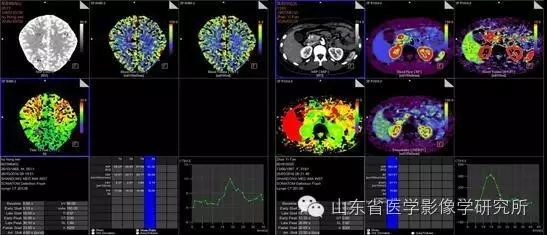 医学影像学简历_简历影像医学学位怎么写_简历影像医学学位怎么填