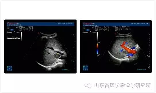 简历影像医学学校怎么写_医学影像学简历_医学影像学简历模板